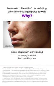 FATION Nosca9 Pore Enhancing Serum: pore background