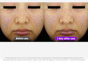 FATION Nosca9 Pore Enhancing Serum: facial test