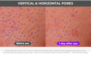 FATION Nosca9 Pore Enhancing Serum: vertical horizontal test