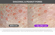 FATION Nosca9 Pore Enhancing Serum: diagonal peanut test