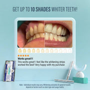 GuruNanda Wireless LED Teeth Whitening Kit supplier view 3