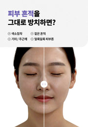 Isntree Onion Newpair Clear Pad 60 Pads: Uneven-tone and mark concern illustration (Korean brand information)