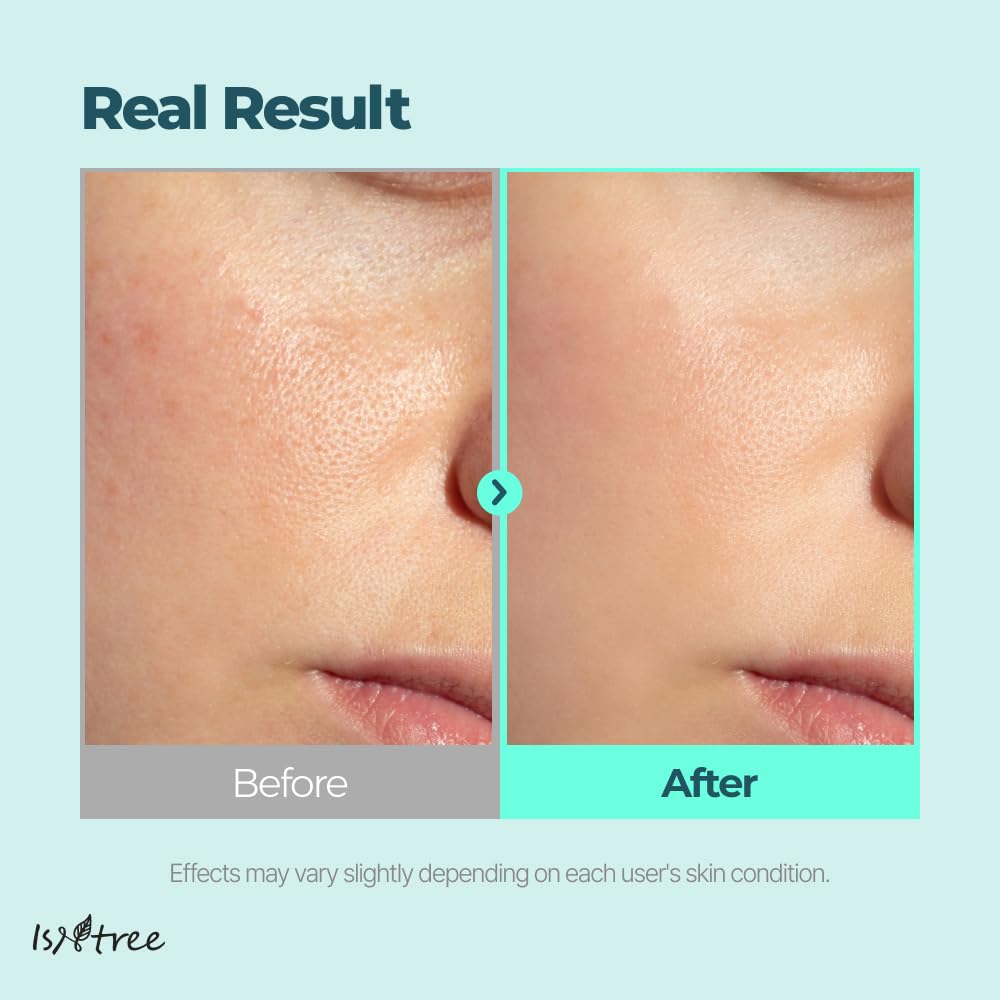 Isntree Gim PDRN Hydro Bouncy Ampoule 50mL appearance comparison information
