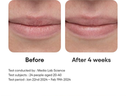 LANEIGE Bouncy and Firm Lip Treatment four-week before-and-after with study details