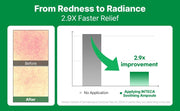 make p:rem Inteca Soothing Ampoule 50mL soothing results