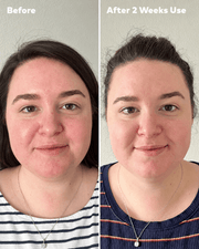 MakeUp Eraser Silver Infused Mini PRO before and after two weeks portrait