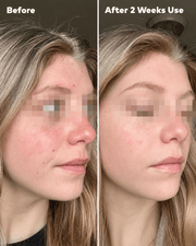 MakeUp Eraser Silver Infused Mini PRO before and after two weeks side profile