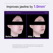 PHYSIOGEL capsule official jawline study with original study qualifications