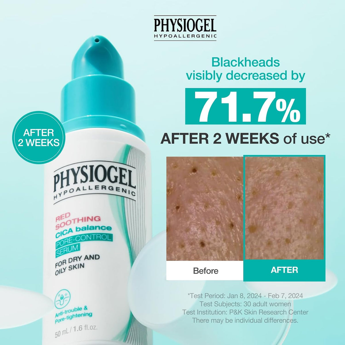 PHYSIOGEL Cica Balance Pore-Control Serum 50ml — Amazon gallery 5