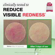 PHYSIOGEL Rosateca Redness Reducing Serum 30ml redness - English Amazon image