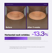 PHYSIOGEL wrinkle official horizontal neck study with original study qualifications