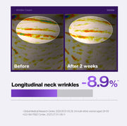PHYSIOGEL wrinkle official longitudinal neck study with original study qualifications