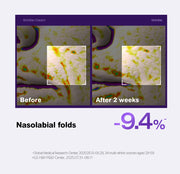 PHYSIOGEL wrinkle official nasolabial study with original study qualifications