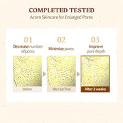 SKINFOOD Acorn Pore Peptide Cream 70mL - Pore size and depth clinical results (English full gallery)