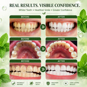 Teeth Restoration Mineral Powder for Yellow Teeth & Stains
