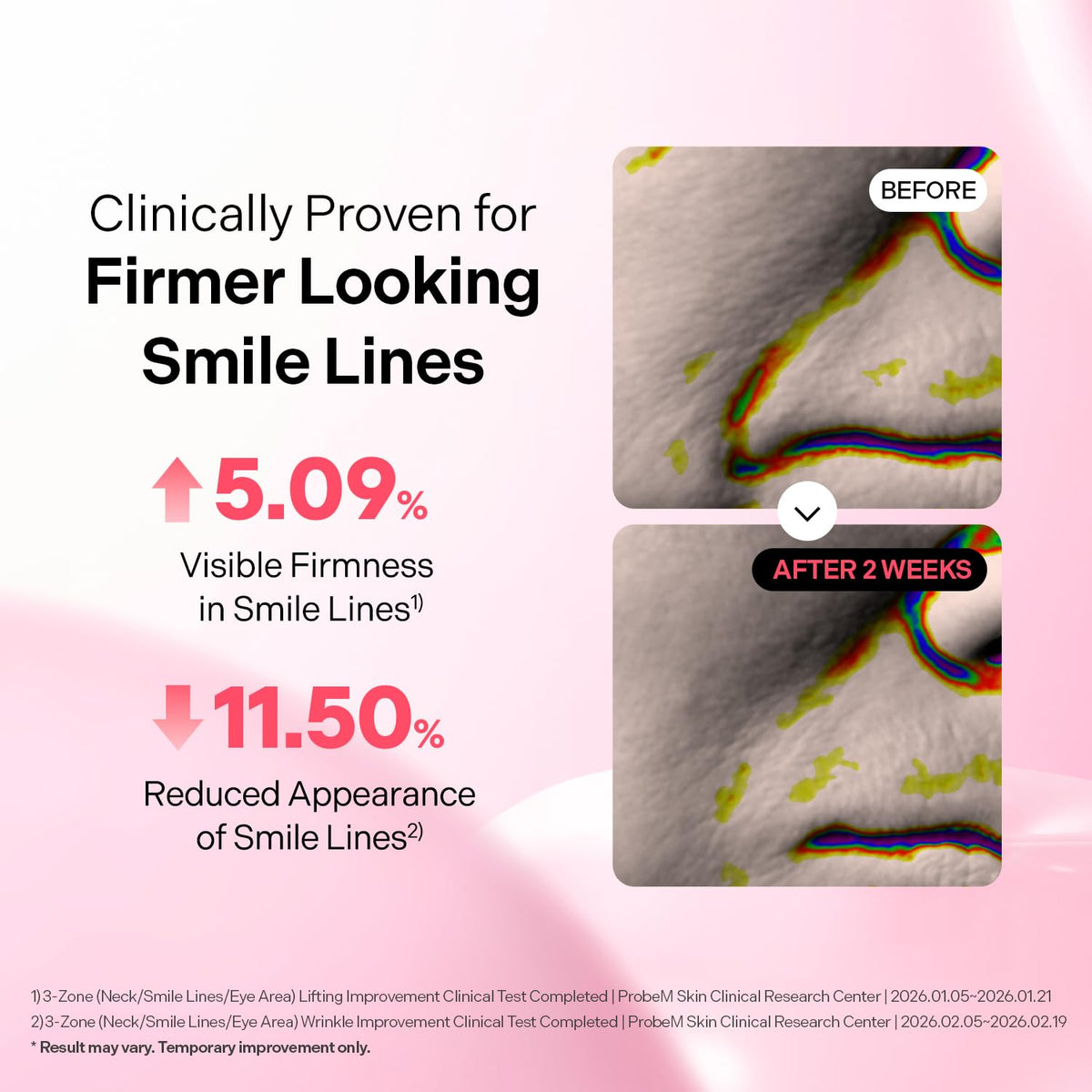Torriden CELLMAZING Firming Patch smile line firming results