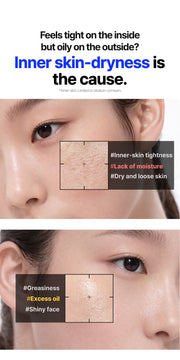 WELLAGE Real Hyaluronic Soothing 100 Cream oily dehydrated skin official information
