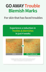 WELLAGE Real Cica Calming 95 Trouble Ampoule: Blemish appearance study