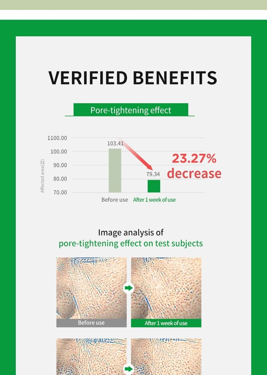 WELLAGE Real Cica Calming Big Embo Toner Pad: Pore appearance study and qualifiers